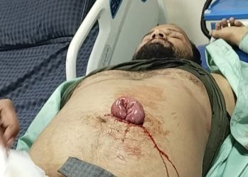 बहेरिया थाना क्षेत्र में युवक पर जानलेवा हमला, चाकुओं के वार से आंतें बाहर आईं, हालत गंभीर